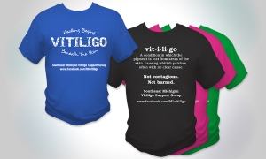 Vitiligo T-shirt Design