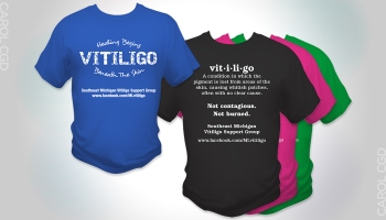 Vitiligo T-shirt Design